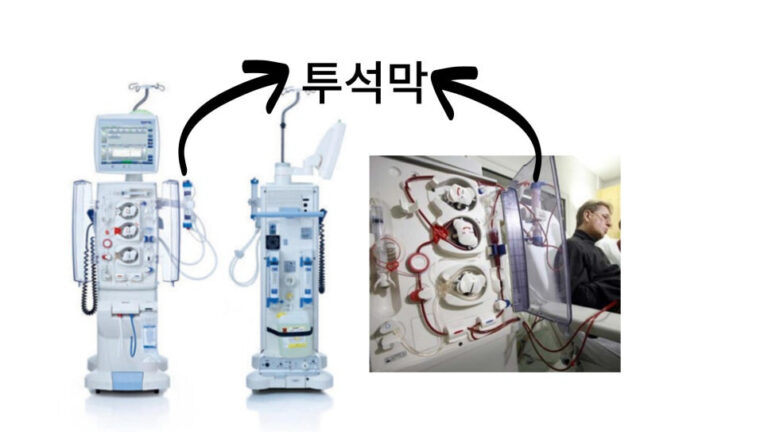 혈액투석 투석막이란? - 아솔내과