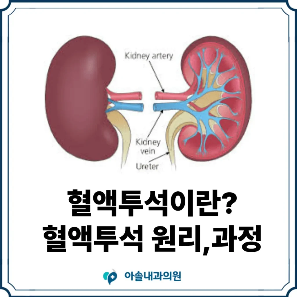 혈액투석이란? 혈액투석 원리와 과정 총정리 | 검단, 풍무동, 불로동 투석 - 아솔내과