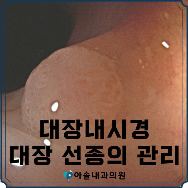 대장내시경 대장 선종의 의미와 관리 - 아솔내과