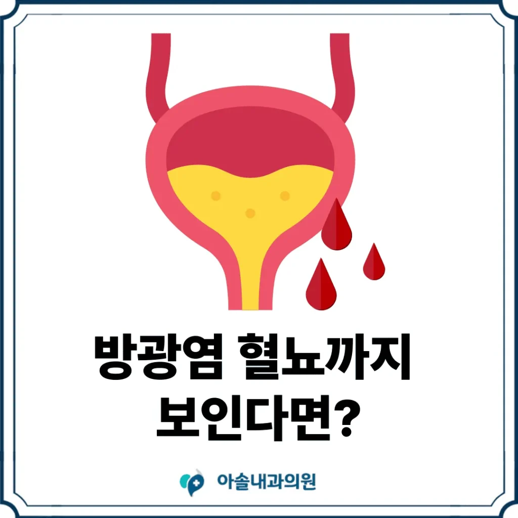 아솔내과 방광염 혈뇨 썸네일