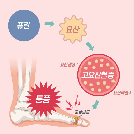 gout1908 main 03