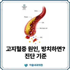 아솔내과 검단 고지혈증 원인 썸네일