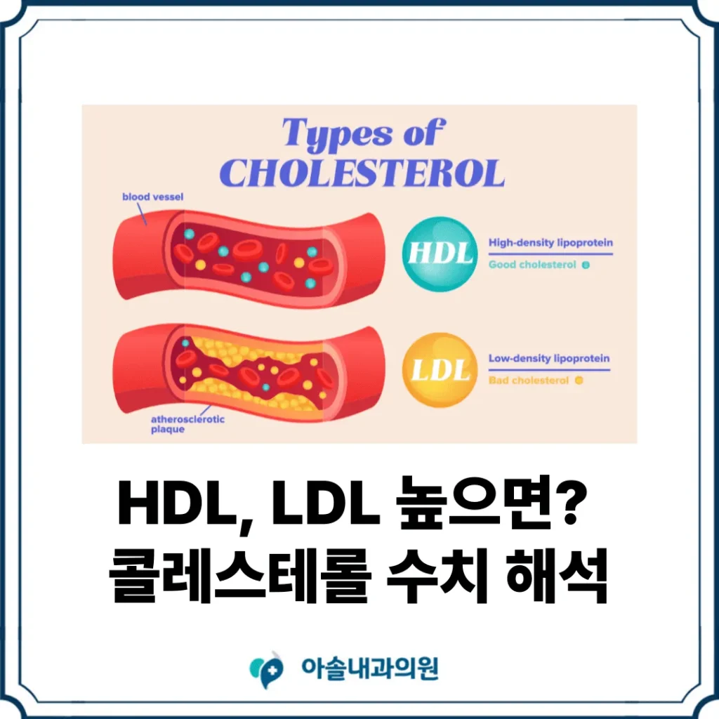 아솔내과 콜레스테롤 높으면 썸네일