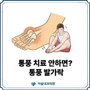 통풍 치료 안하면 썸네일