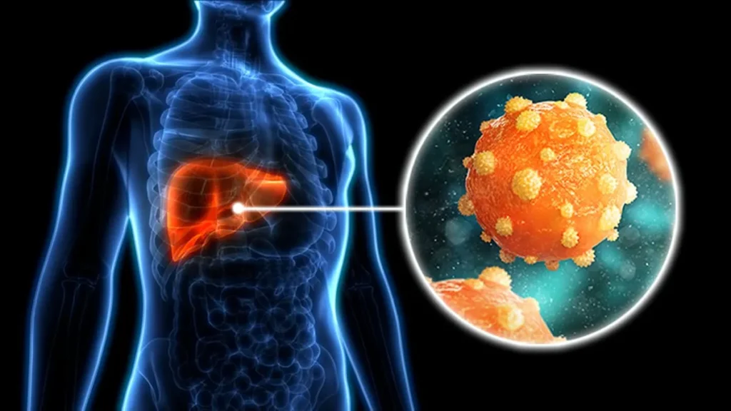 what is hepatitis b thumbnail 11zon