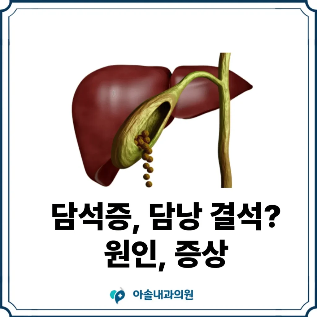 검단 담석증, 담낭 결석? 원인 증상 | 검단 건강검진 담석 - 아솔내과
