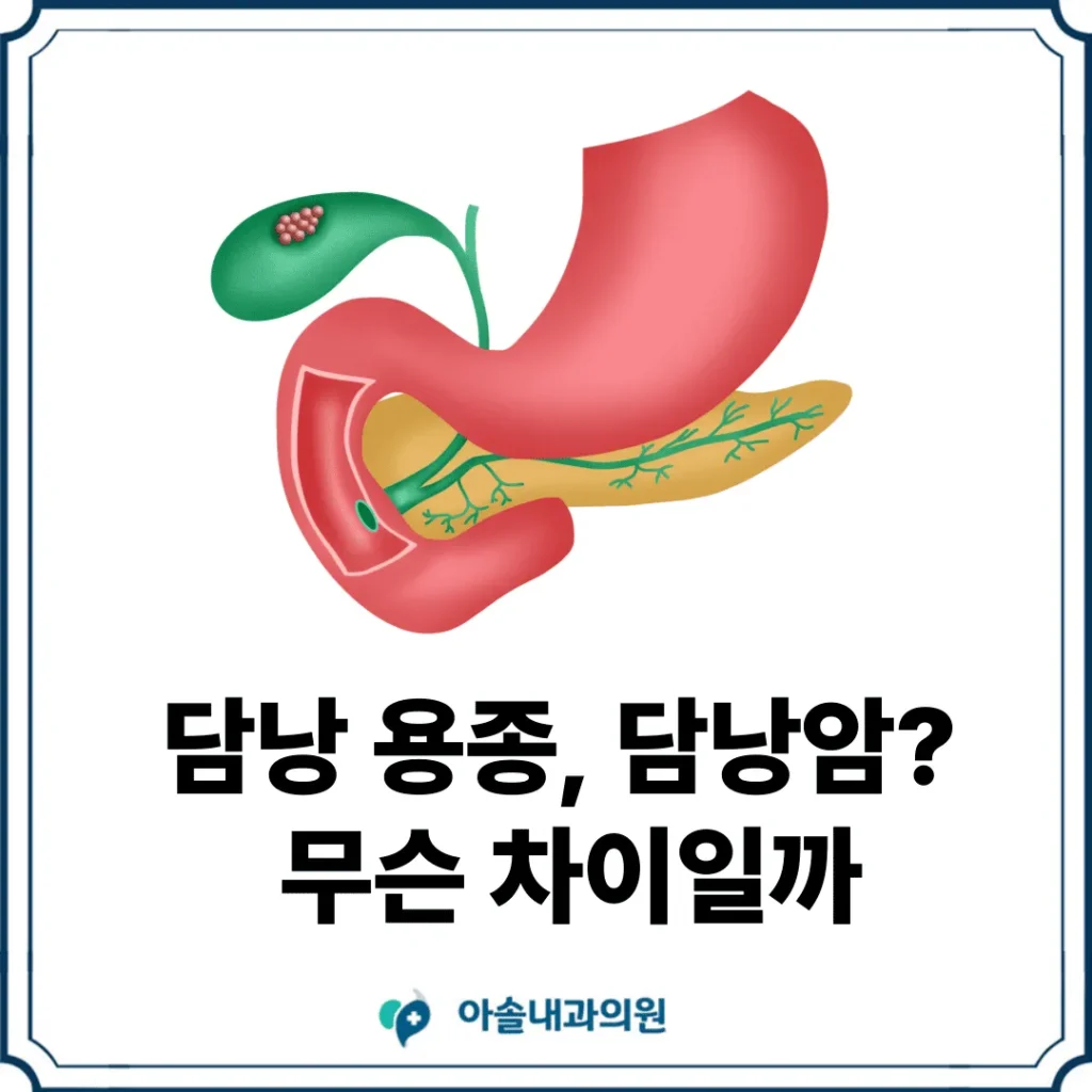 검단 담낭 용종 담낭암 썸네일