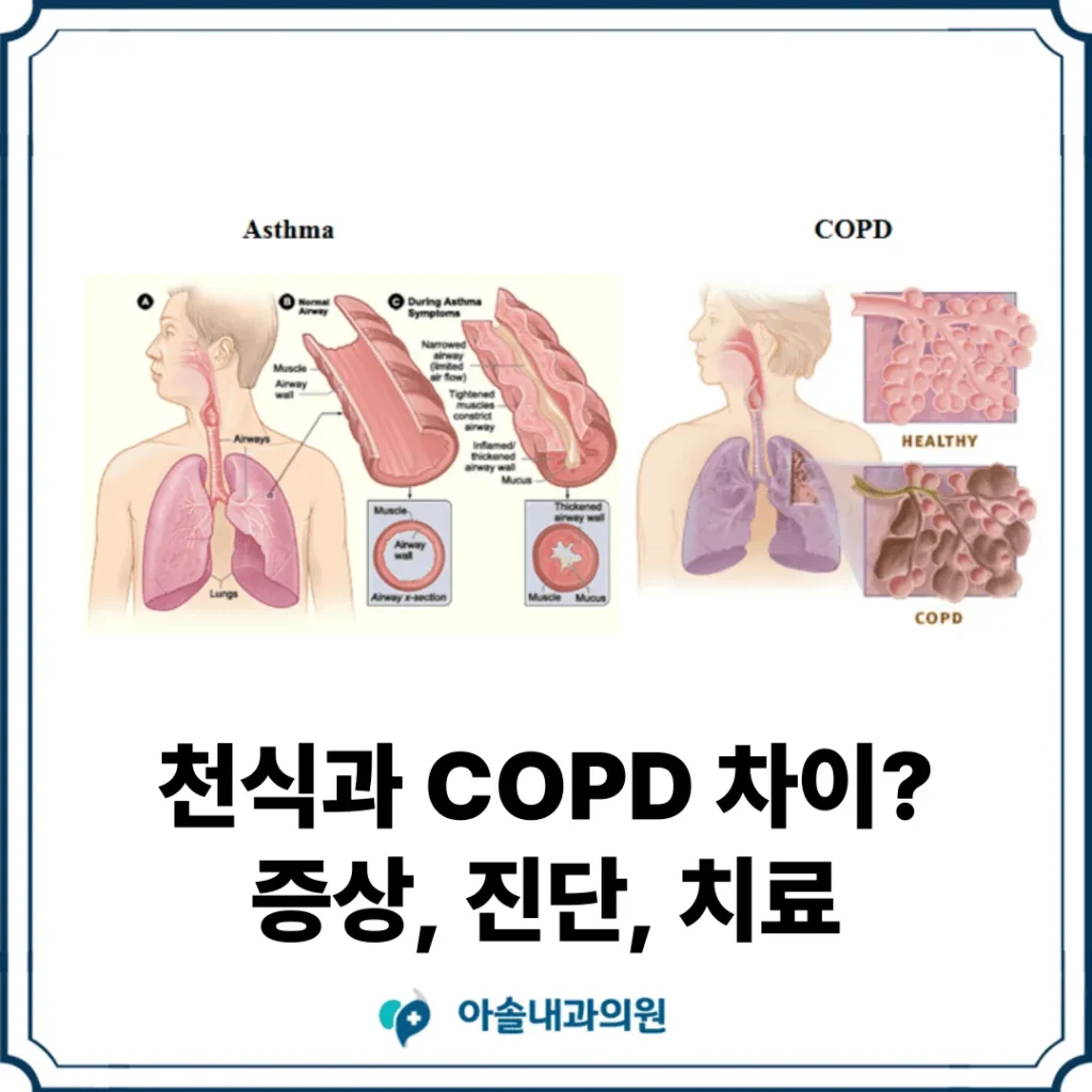 검단 천식 COPD
