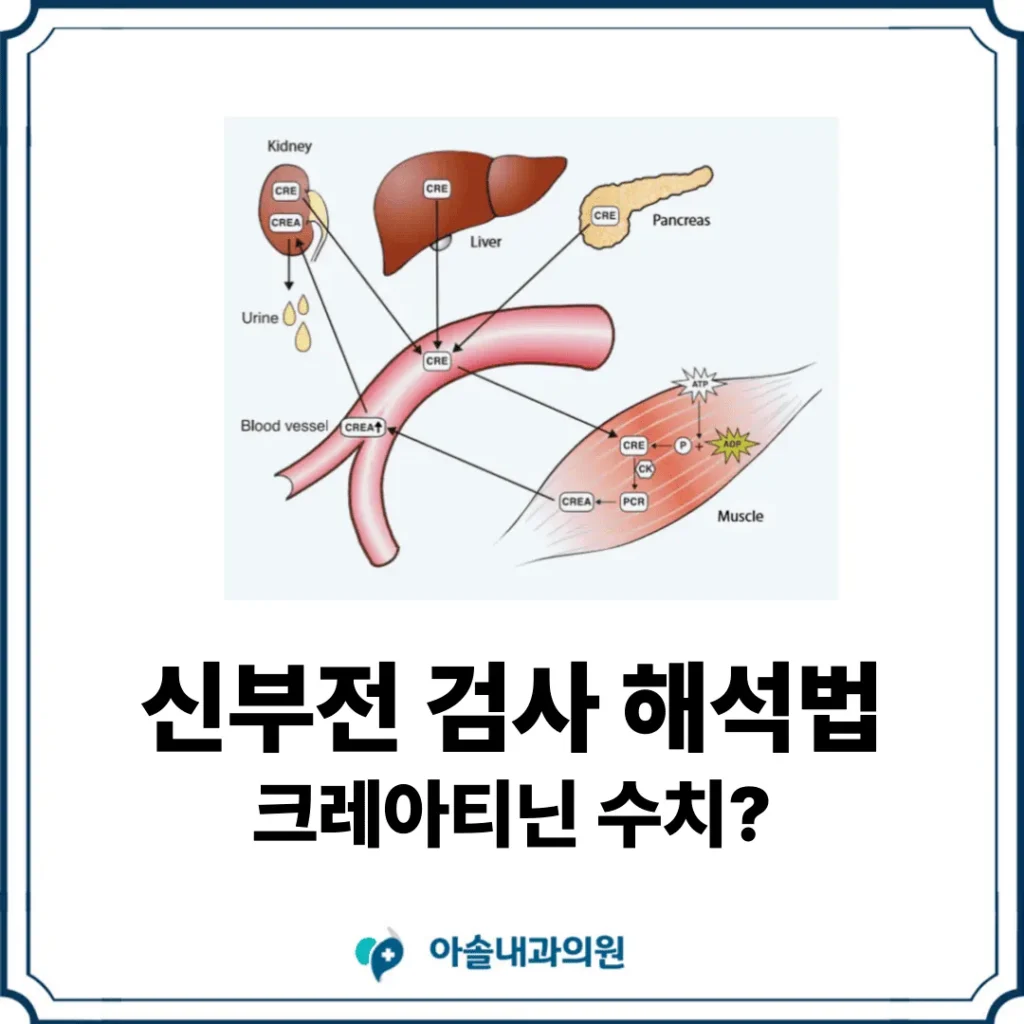 만성신부전 검사 크레아티닌 수치 검사 썸네일