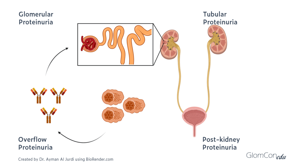 Ayman Neph Proteinuria Hematuria revised