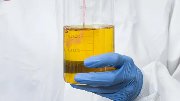 Sterile Pyuria Article