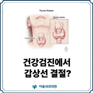 갑상선 결절 썸네일