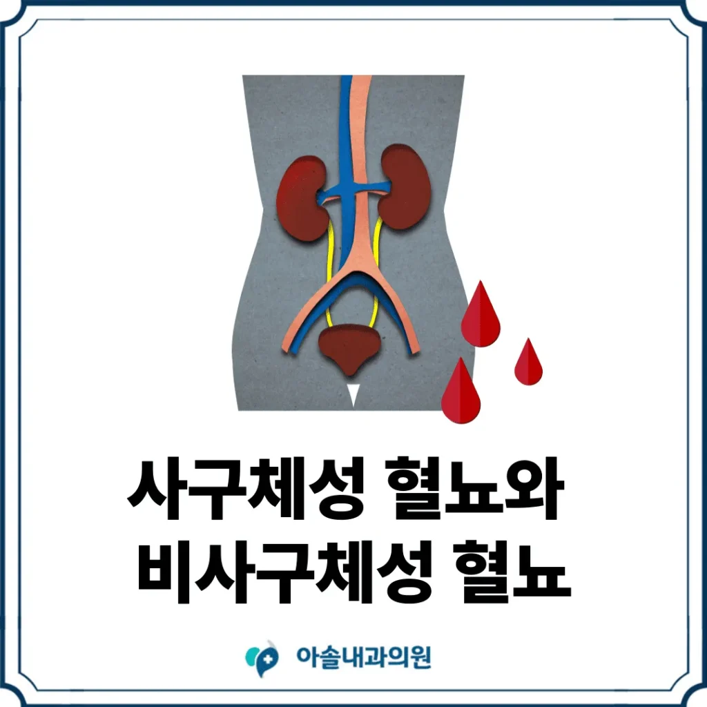사구체성 혈뇨 썸네일