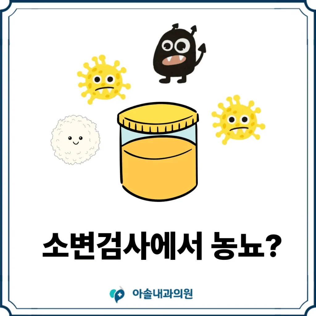 소변검사에서 농뇨 썸네일