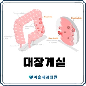 대장게실