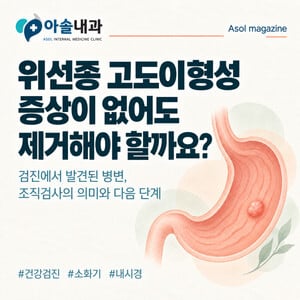 위선종 고도이형성, 증상이 없어도 제거를 검토하는 3가지 이유